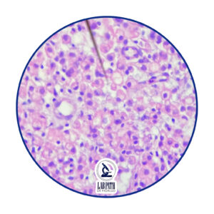 LABORATORIO PATOLOGÍA (14)