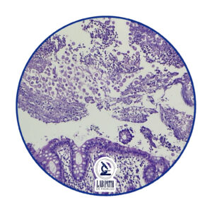 LABORATORIO PATOLOGÍA (4)