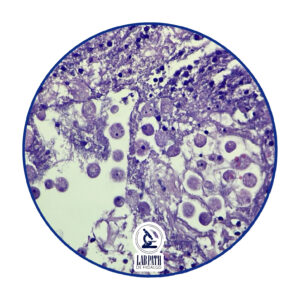 LABORATORIO PATOLOGÍA (6)